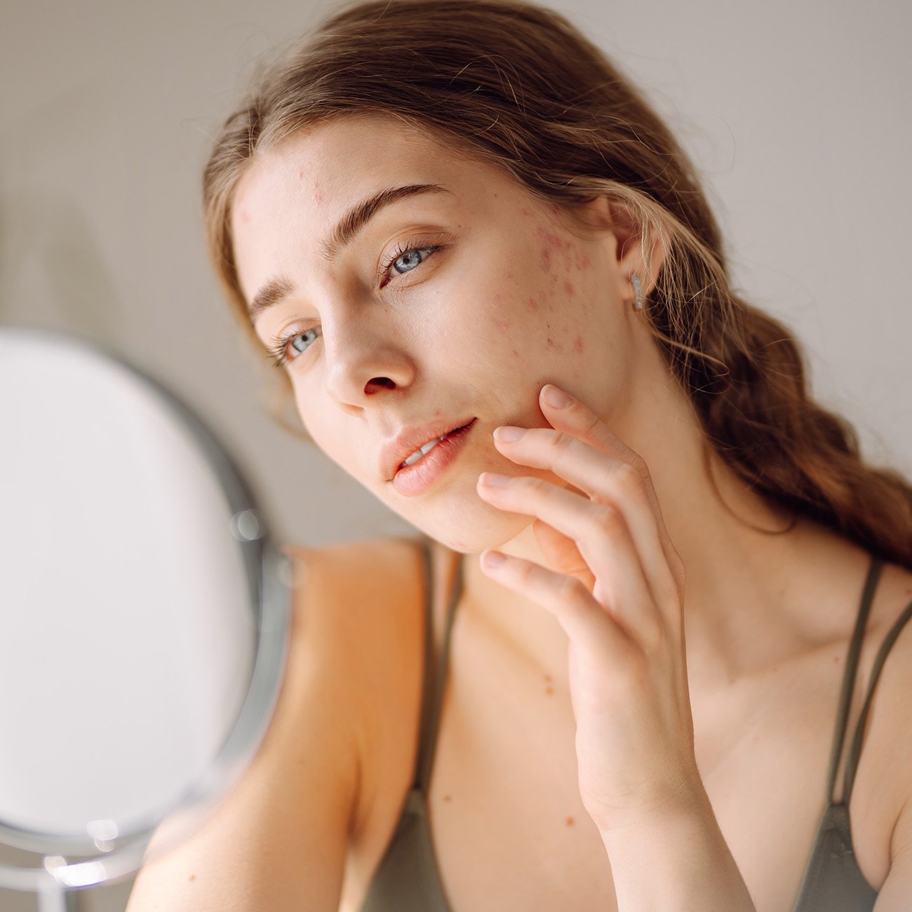 Młoda kobieta ogląda swoją cerę z niedoskonałościami przed lusterkiem