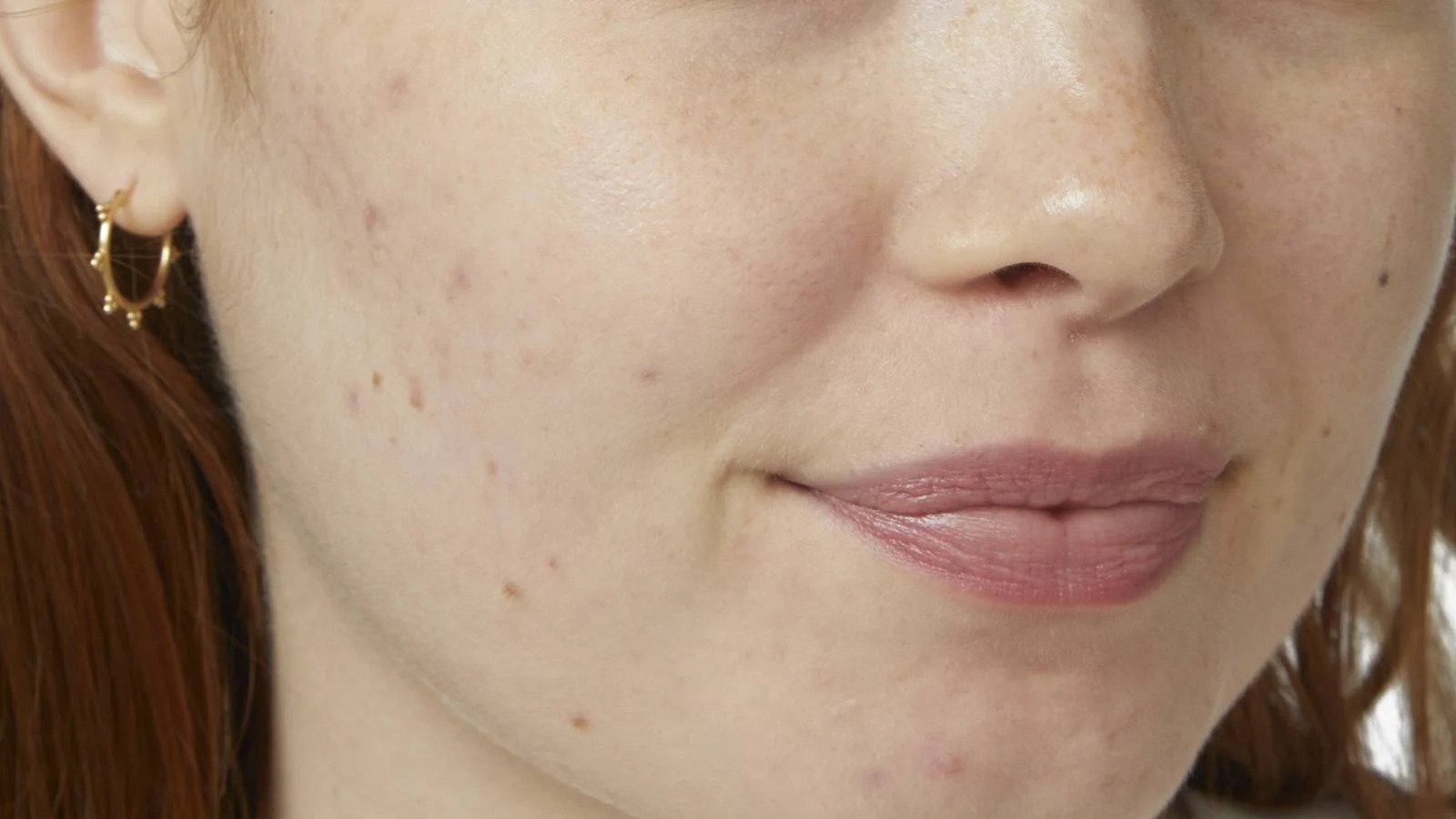 skin tint before modul